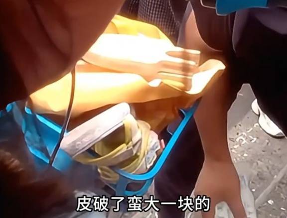 看著都疼<strong></p>
<p>西鳳酒
</strong>！上海街頭一男子突然求助：10歲女兒被死死卡住！這個行為太危險→:西鳳酒
