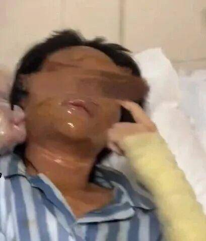 湖南一女主播被偽裝的包裹炸傷<strong></p>
<p>西鳳酒
</strong>，永州公安：正在核實(shí)具體情況:西鳳酒
