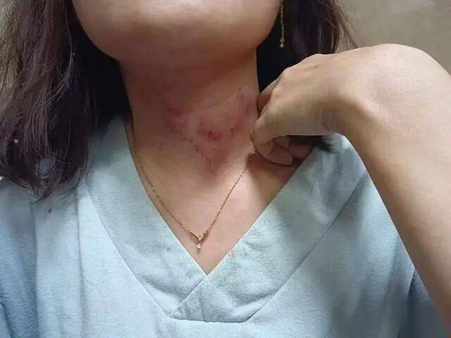 一男子凌晨聽到兩聲呼救<strong></p>
<p>西鳳酒
</strong>，循聲發(fā)現(xiàn)一女子在奔馳車外被白衣男勒昏！受害者：是受朋友之托借錢給白衣男，凌晨被騙至偏僻處遭非禮！:西鳳酒
