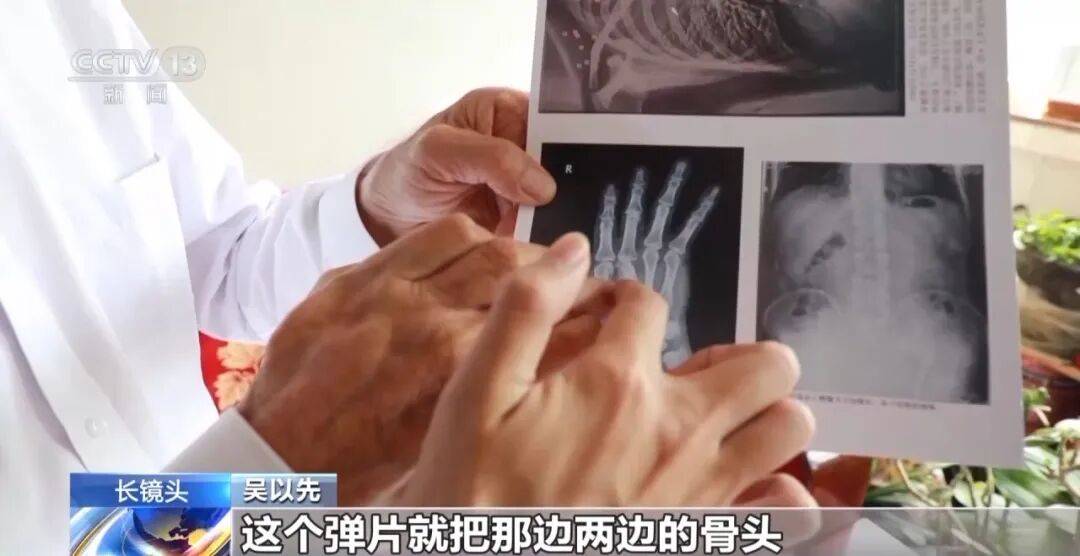 “老先生<strong></p>
<p>西鳳酒
</strong>，您把項鏈取下來再做CT”“你看是不是彈片”:西鳳酒
